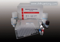 人系统性红斑狼疮（SLE）ELISA试剂盒供应