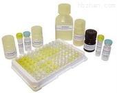 人基质金属蛋白酶检测试剂盒